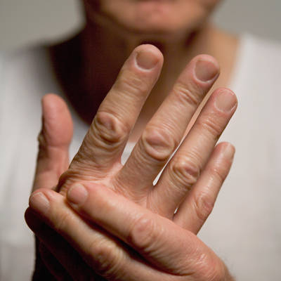 Stock photo of a persons hand, person is holding it in the insinuation of pain.